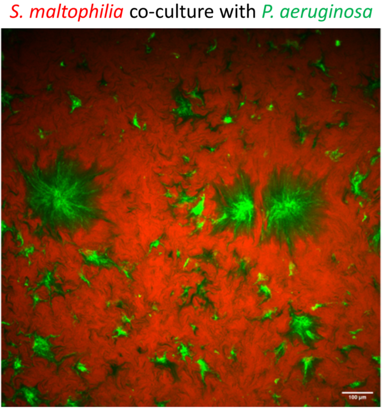 Stenotrophomonas Maltophilia Antibacterial Mechanisms Joanna Goldberg   Stenotrophomonas Pseudomonas Co Culture 768x827 