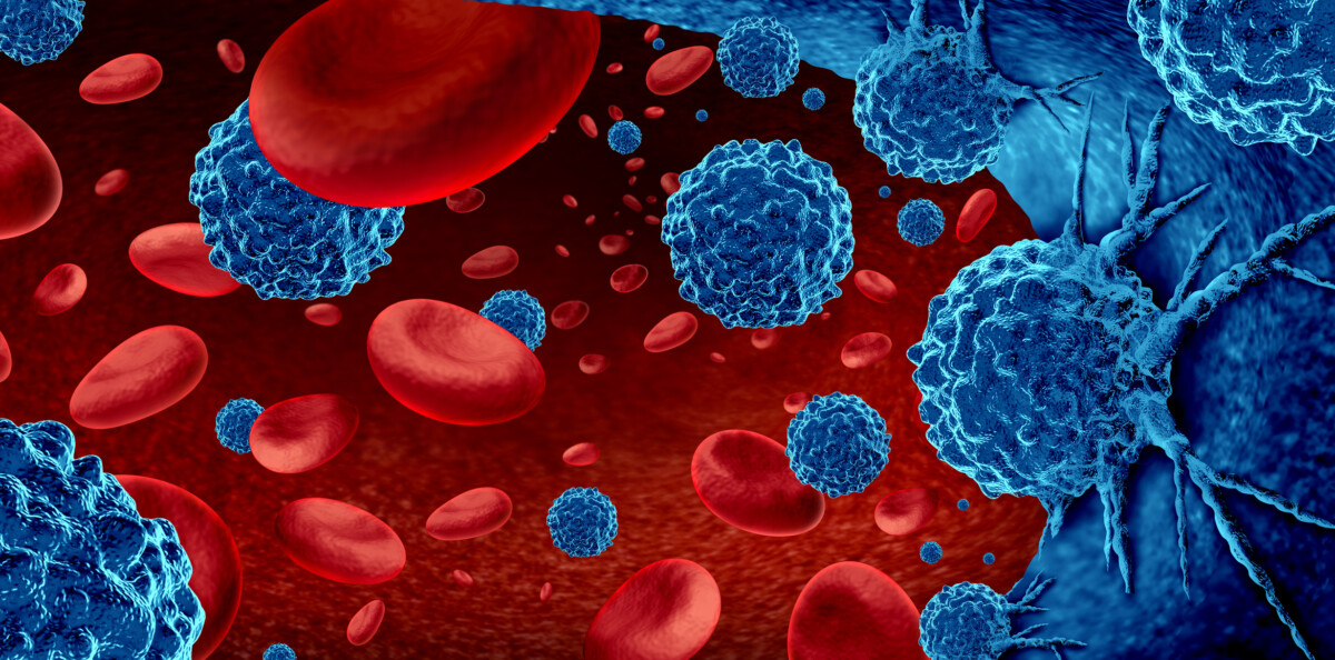 Illustration of blood cancer